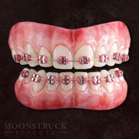 fake braces cosplay|fake braces on etsy.